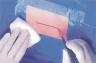 華衛(wèi)醫(yī)用手術膜 透氣手術膜